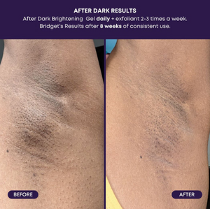 Bushbalm After Dark Brightening Gel